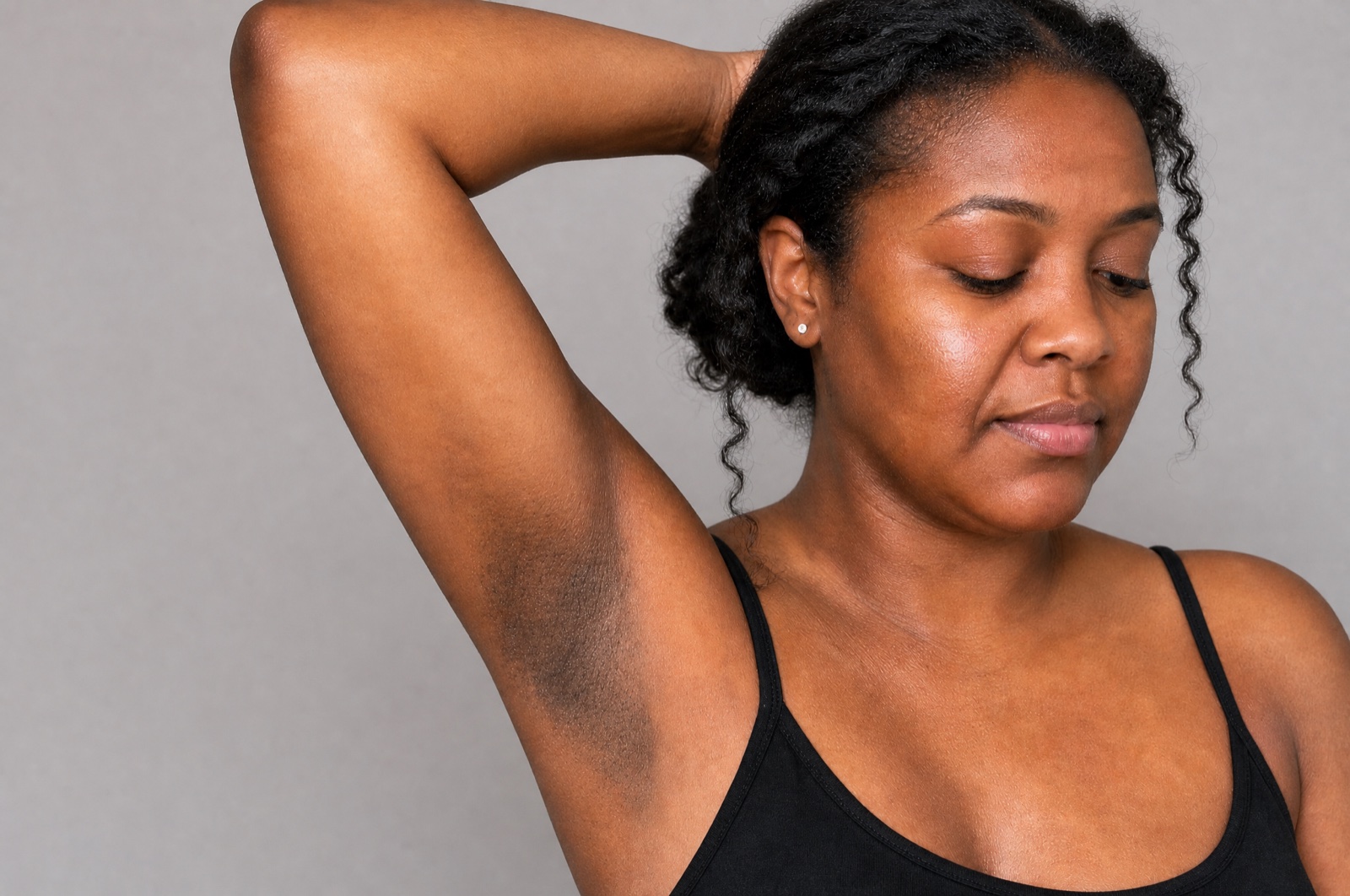 Underarm before — darker, uneven pigment