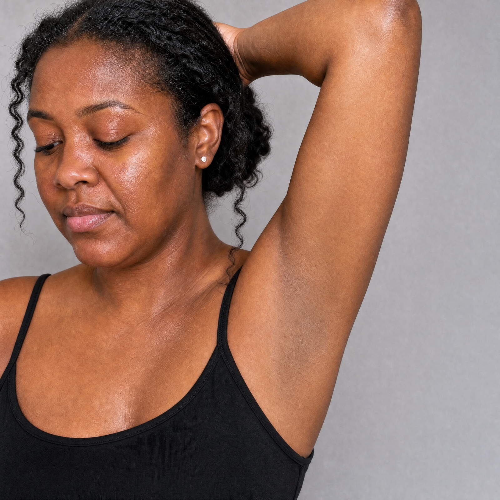 Underarm after 8 weeks — even, calmer tone