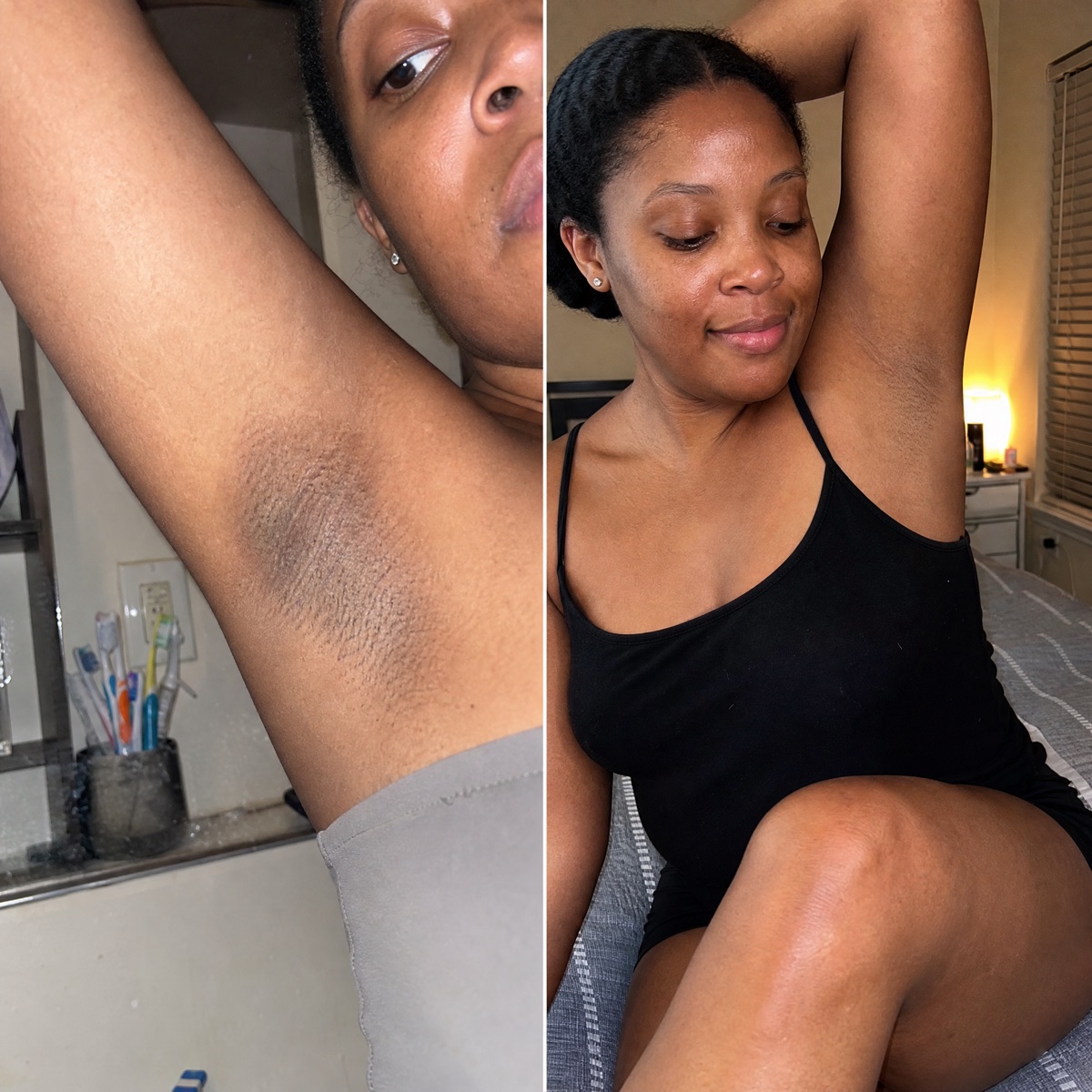 Reader's underarm before and after