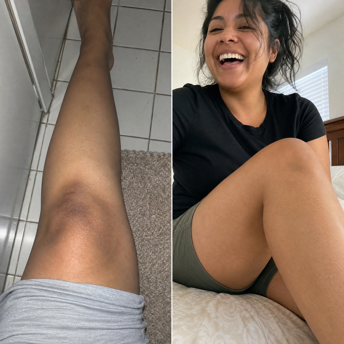 Reader's knee before and after