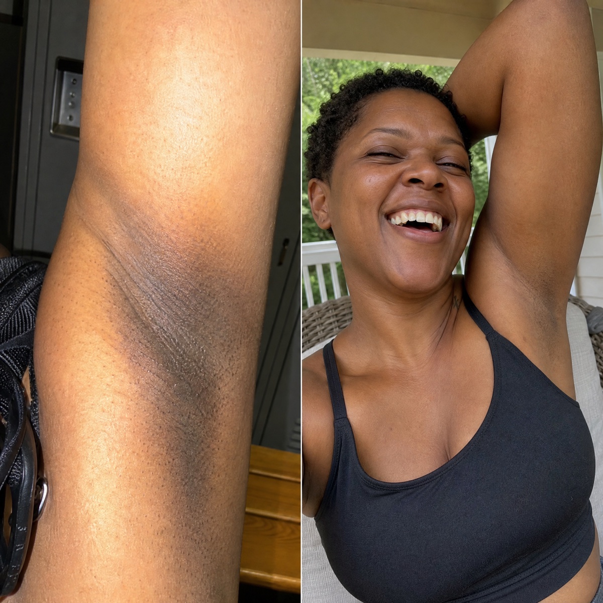 Reader's underarm before and after
